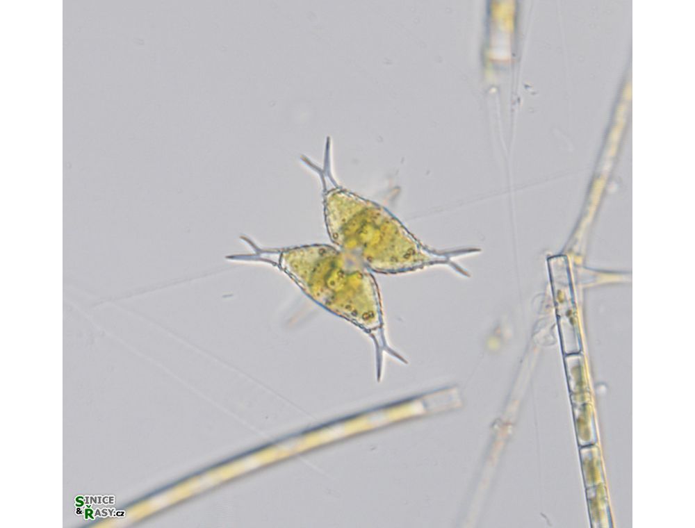 Staurastrum subcruciatum