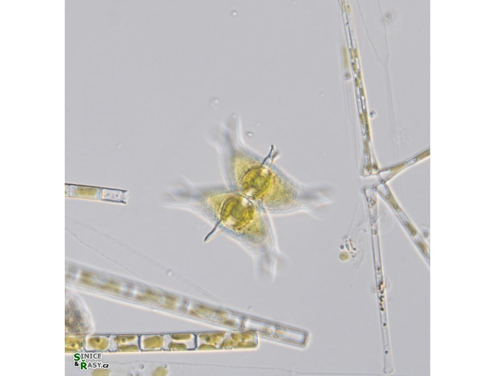 Staurastrum subcruciatum