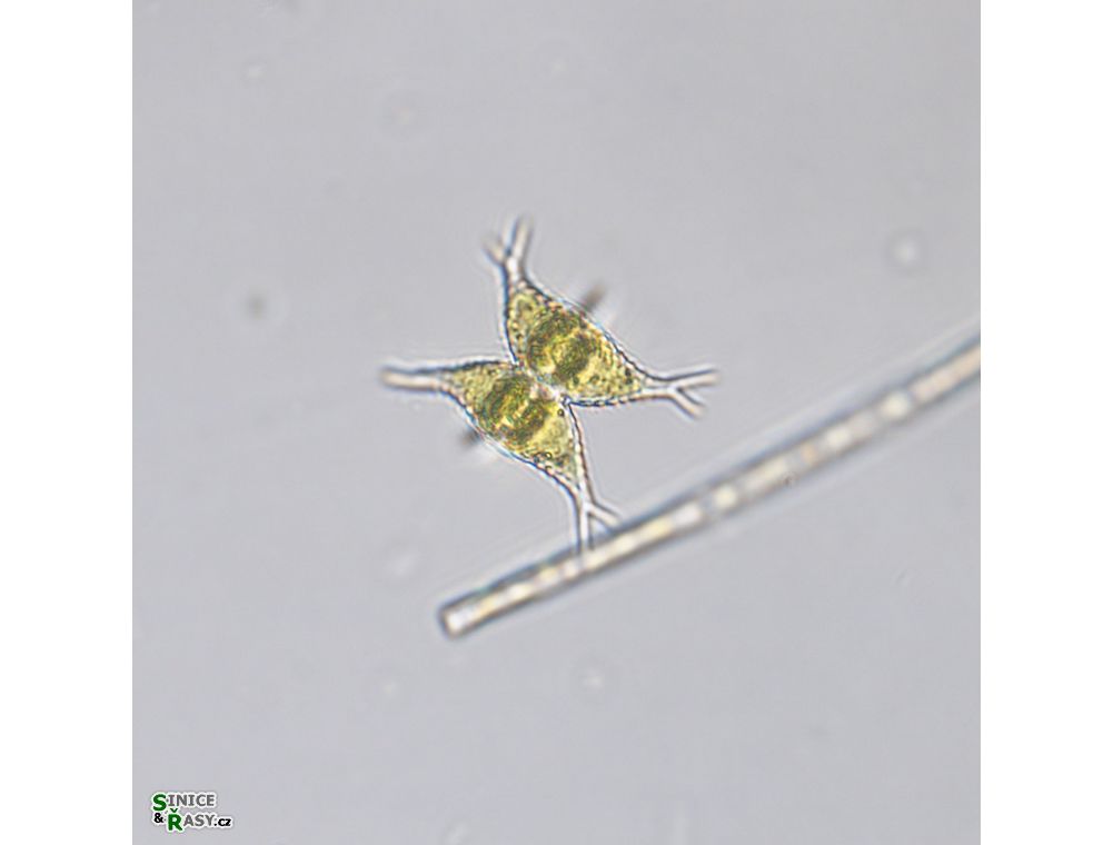 Staurastrum subcruciatum