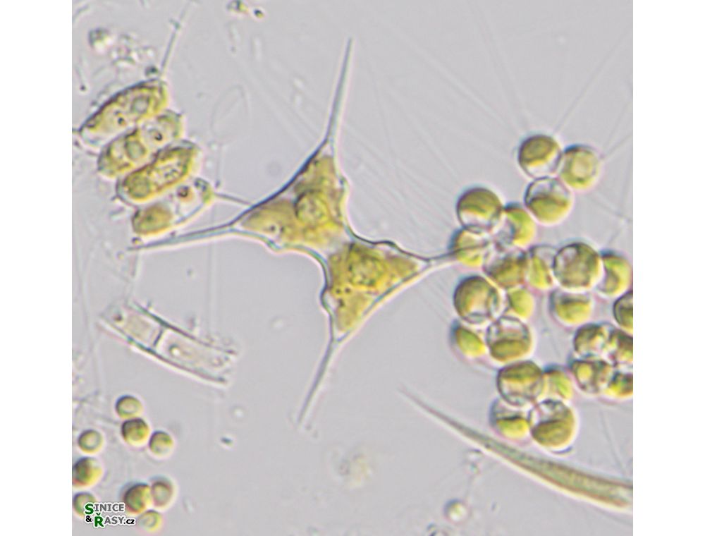 Staurodesmus extensus