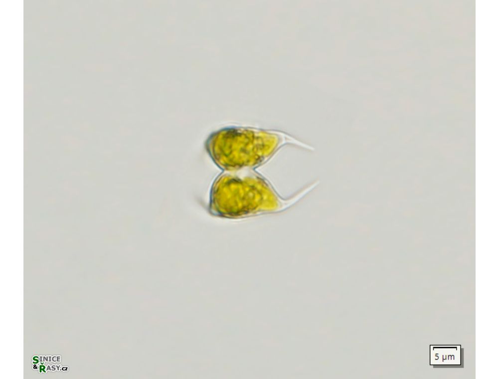 Staurodesmus glaber