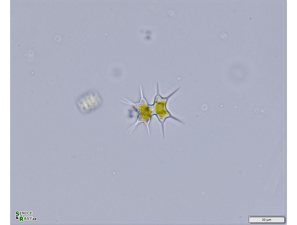 Staurodesmus octocornis