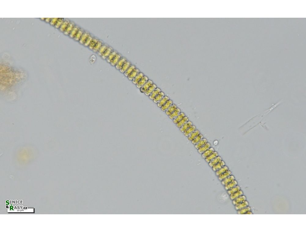 Teilingia granulata
