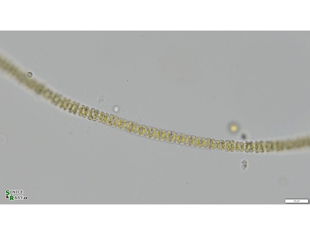 Teilingia granulata
