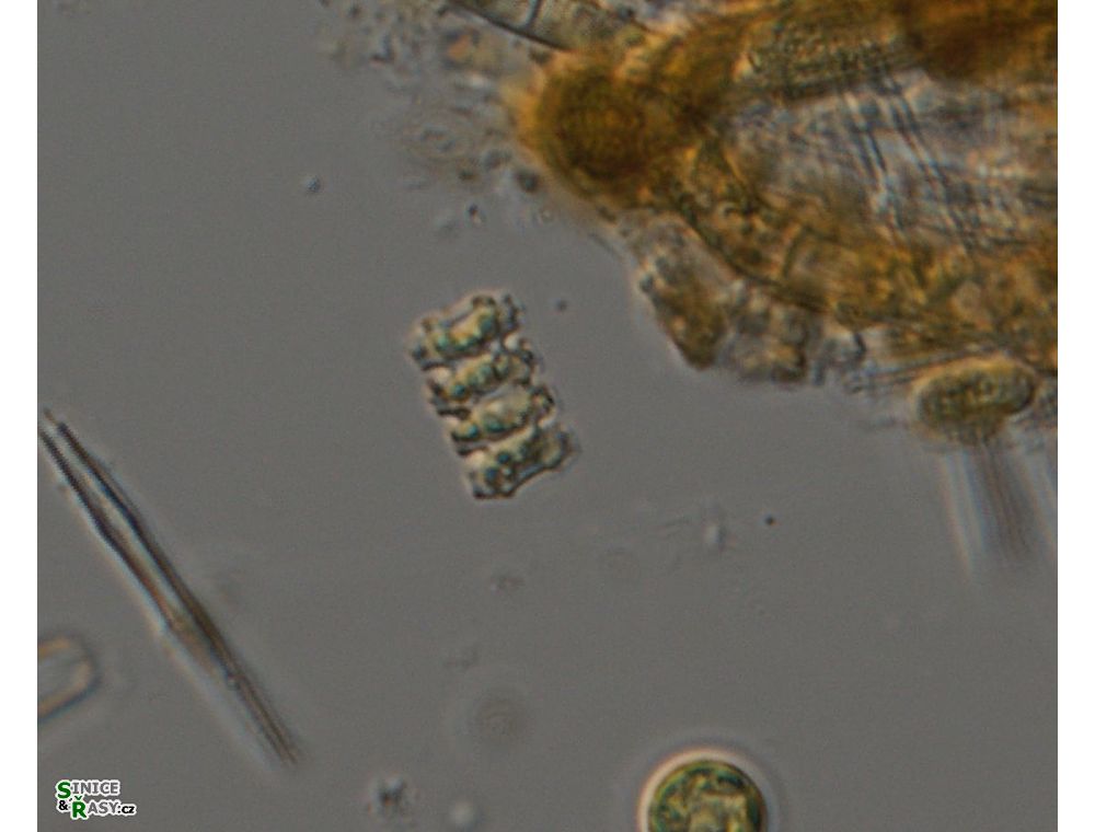Teilingia wallichii