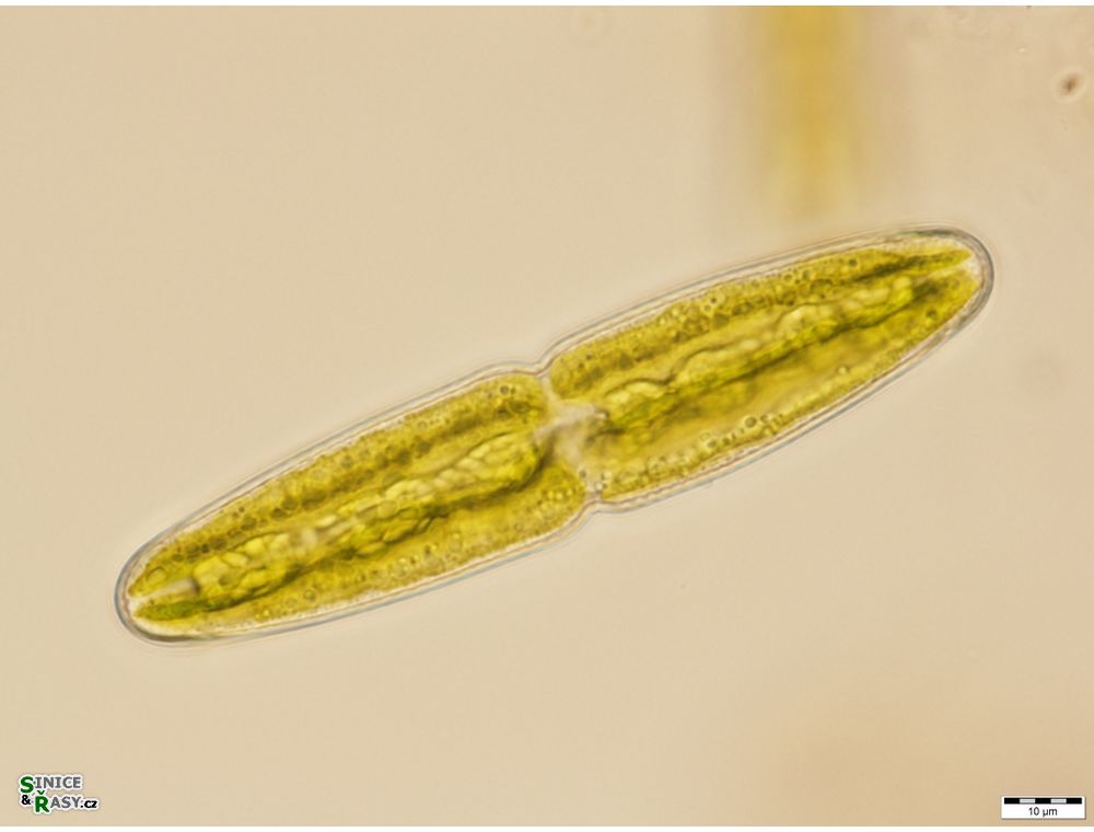 Tetmemorus brebissonii