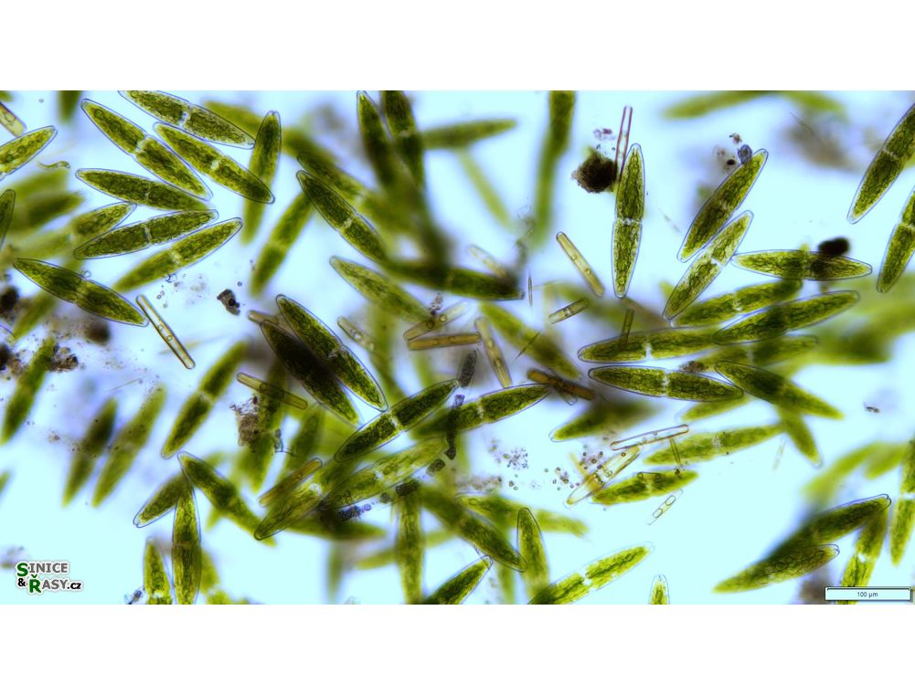 Tetmemorus granulatus