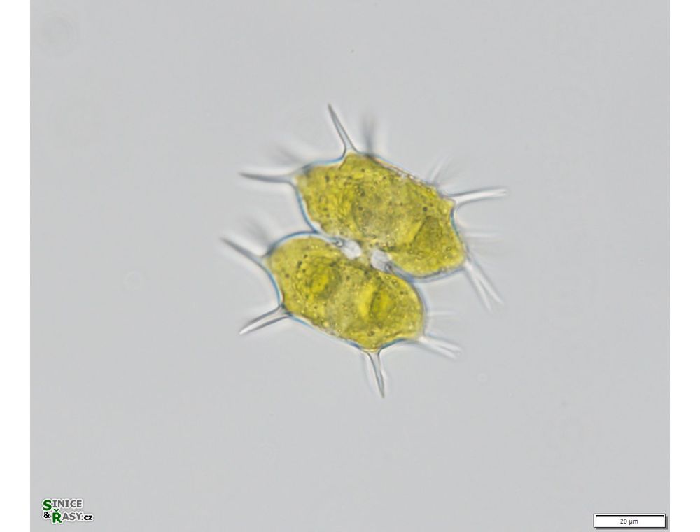 Xanthidium antilopaeum