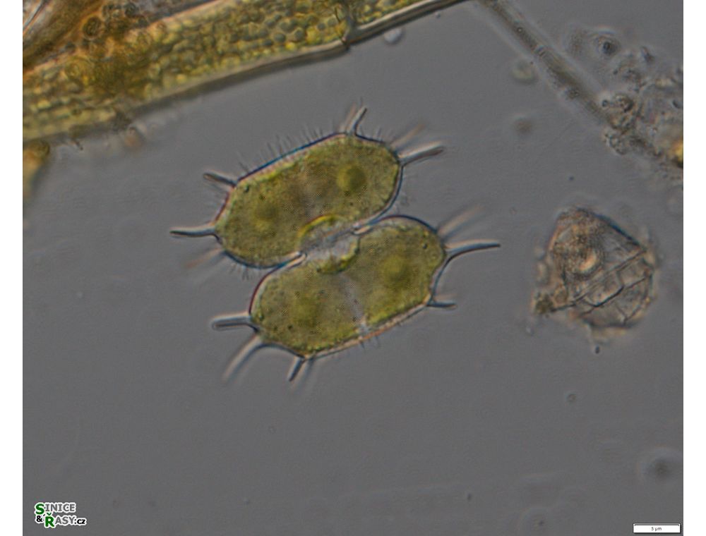 Xanthidium antilopaeum