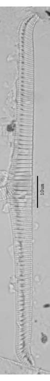 Rhopalodia gibba