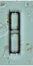 Aulacoseira subarctica