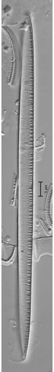 Nitzschia linearis
