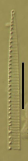 Nitzschia radicula