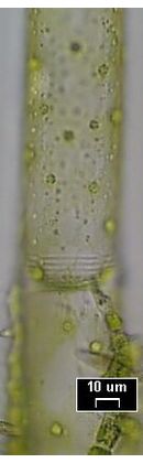 Oedogonium