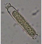 Aphanizomenon gracile