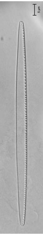 Nitzschia intermedia