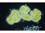 Botryococcus braunii