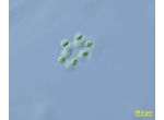 Dictyosphaerium