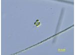 Micractinium