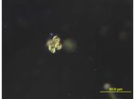 Oocystis marssonii