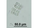 Willea irregularis