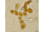 Trentepohlia