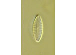 Achnanthidium