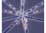 Asterionella