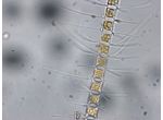 Chaetoceros