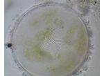 Coscinodiscus