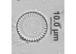 Cyclotella