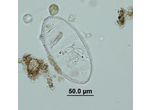 Cymatopleura