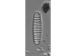 Diatoma