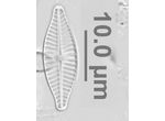 Planothidium