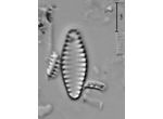 Pseudostaurosira