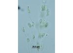Dinobryon sertularia