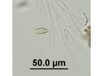 Epipyxis