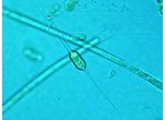 Centritractus