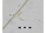 Ophiocytium