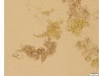 CT113 - Nostoc