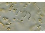 CT114 - Nostoc