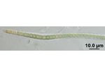 CT16 - Brasilonema sp.