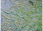 CT161 - Fischerella/Westiellopsis