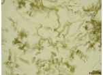 CT162 - Westiellopsis sp.