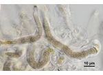 CT18 - Scytonematopsis sp.
