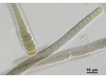 CT27 - Microchaete sp.