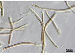 CT281 - Microchaete sp.