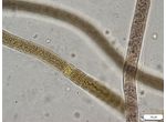 CT36 - Brasilonema sp.