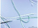 CT47 - Brasilonema sp.