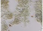 CT79 - cf. Nostoc